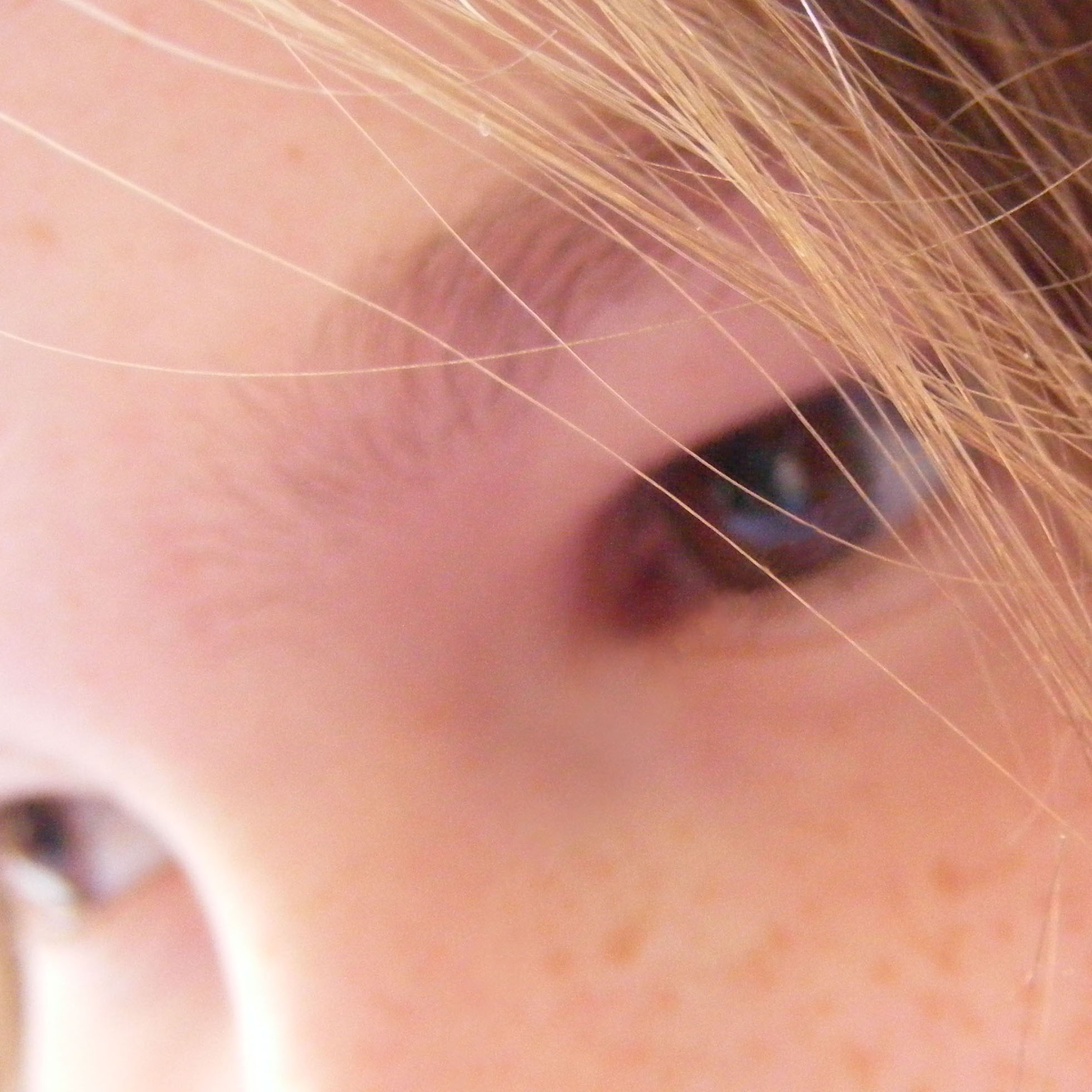 Caitlin eye